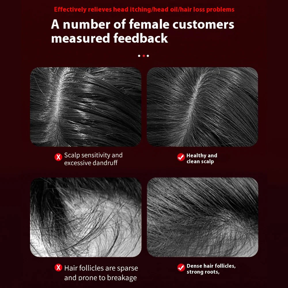 Calmory™ Hair Renewal Device
