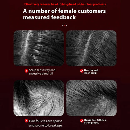 Calmory™ Hair Renewal Device